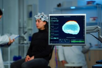 Alzheimer: estudo identifica ondas cerebrais que podem ajudar a prever risco da doença
