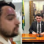 Assessor de Jair Renan investigado por agredir primo após vitória de Lula pede exoneração do cargo