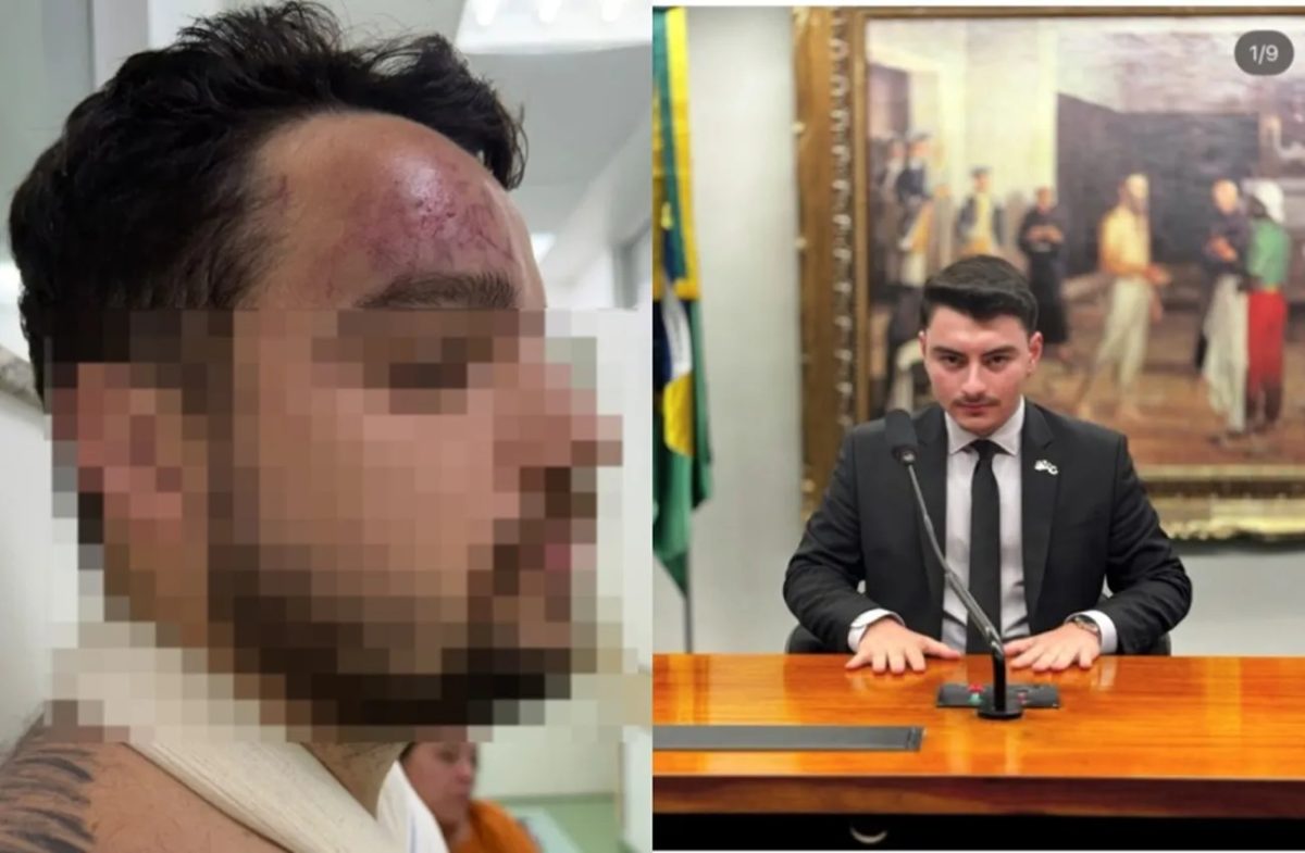 Assessor de Jair Renan investigado por agredir primo após vitória de Lula pede exoneração do cargo