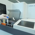 Exame de sangue para Alzheimer chega ao Brasil: veja quem pode fazer, quanto custa e o que o resultado revela