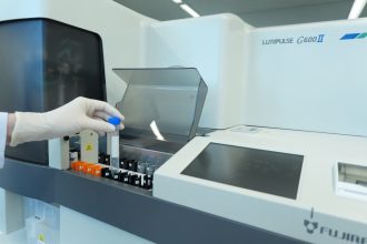 Exame de sangue para Alzheimer chega ao Brasil: veja quem pode fazer, quanto custa e o que o resultado revela
