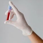 Exame para diagnosticar Alzheimer é disponibilizado no Brasil