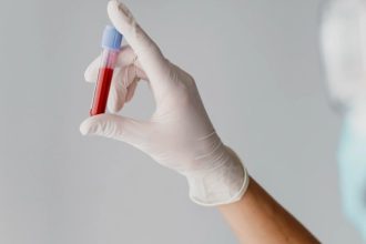 Exame para diagnosticar Alzheimer é disponibilizado no Brasil