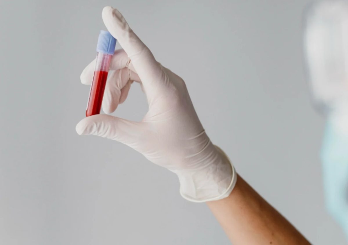 Exame para diagnosticar Alzheimer é disponibilizado no Brasil
