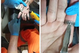 Jovem busca ajuda dos bombeiros após ficar com anel preso no dedo em Januária