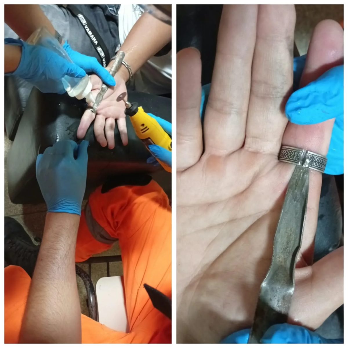 Jovem busca ajuda dos bombeiros após ficar com anel preso no dedo em Januária