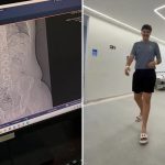 Jovem engole aliança sem querer, vai parar no hospital e viraliza na web; VÍDEO