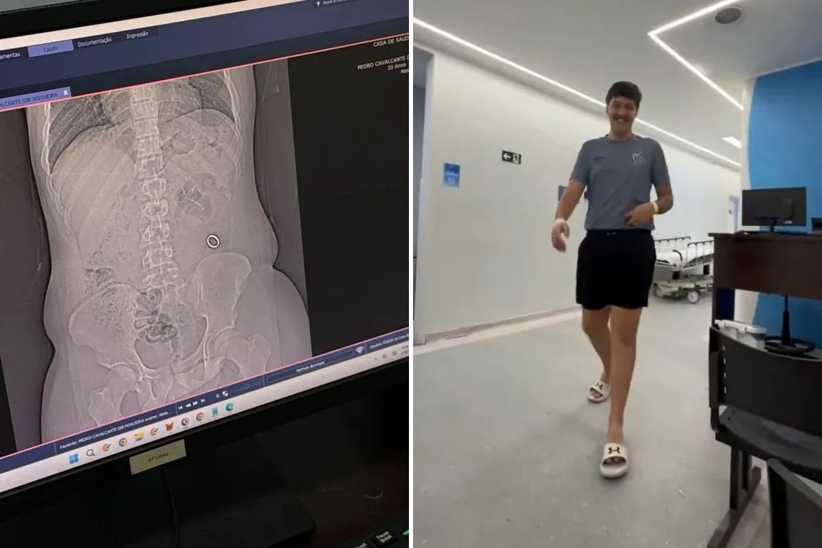 Jovem engole aliança sem querer, vai parar no hospital e viraliza na web; VÍDEO