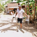 Líder comunitário que teve perna amputada consegue prótese com apoio da DPE-RR: 'mudou a minha vida'