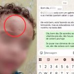 Mãe denuncia creche após menino de 2 anos aparecer com hematoma no rosto no litoral de SP