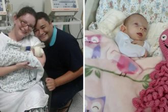 Menina com paralisia cerebral 'luta' contra o próprio crescimento por cirurgia que contém rigidez muscular